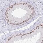 EID3 Antibody in Immunohistochemistry (Paraffin) (IHC (P))