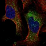 TMEM222 Polyclonal Antibody