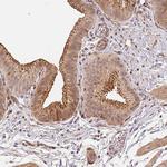 TMEM222 Antibody in Immunohistochemistry (Paraffin) (IHC (P))