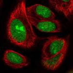 ZNF593 Polyclonal Antibody