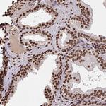 ZNF593 Antibody in Immunohistochemistry (Paraffin) (IHC (P))
