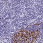 CDCA4 Antibody in Immunohistochemistry (IHC)