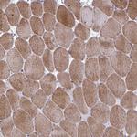GRXCR2 Antibody in Immunohistochemistry (IHC)