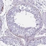 GRXCR2 Antibody in Immunohistochemistry (IHC)