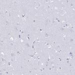 GRXCR2 Antibody in Immunohistochemistry (IHC)