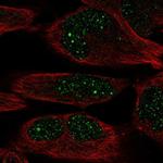 ZNF221 Polyclonal Antibody