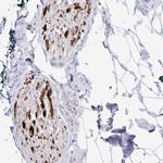 CRG-L2 Polyclonal Antibody