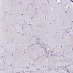 OR4B1 Antibody in Immunohistochemistry (Paraffin) (IHC (P))