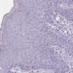 OR4B1 Antibody in Immunohistochemistry (Paraffin) (IHC (P))