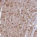 SLC9A6 Polyclonal Antibody