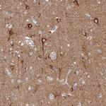 SLC9A6 Antibody in Immunohistochemistry (IHC)