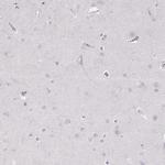 Desmoglein 4 Antibody in Immunohistochemistry (Paraffin) (IHC (P))