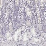 Desmoglein 4 Antibody in Immunohistochemistry (Paraffin) (IHC (P))