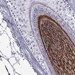 Desmoglein 4 Antibody in Immunohistochemistry (IHC)
