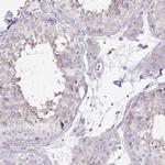 OR4P4 Polyclonal Antibody