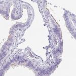 OR5J2 Polyclonal Antibody