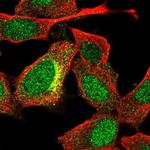 UGT3A2 Polyclonal Antibody