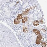 PRR20A Polyclonal Antibody