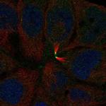 CEACAM18 Polyclonal Antibody