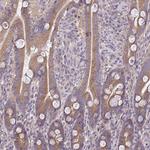 CEACAM18 Antibody in Immunohistochemistry (Paraffin) (IHC (P))