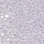 CEACAM18 Antibody in Immunohistochemistry (Paraffin) (IHC (P))