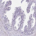 CEACAM18 Antibody in Immunohistochemistry (Paraffin) (IHC (P))