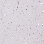 CEACAM18 Antibody in Immunohistochemistry (Paraffin) (IHC (P))