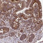 ALDH16A1 Antibody in Immunohistochemistry (Paraffin) (IHC (P))