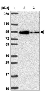 ALDH16A1 Antibody in Western Blot (WB)