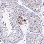 ZSCAN5B Polyclonal Antibody