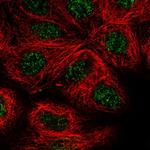 JDP2 Antibody in Immunocytochemistry (ICC/IF)