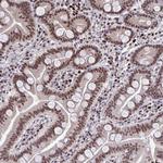 JDP2 Antibody in Immunohistochemistry (Paraffin) (IHC (P))