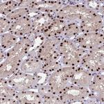 JDP2 Antibody in Immunohistochemistry (Paraffin) (IHC (P))