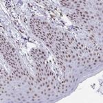 JDP2 Antibody in Immunohistochemistry (Paraffin) (IHC (P))