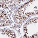 C14orf39 Antibody in Immunohistochemistry (Paraffin) (IHC (P))