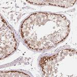 MAP7D2 Antibody in Immunohistochemistry (Paraffin) (IHC (P))