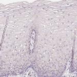 MAP7D2 Antibody in Immunohistochemistry (IHC)