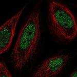 SS18 Polyclonal Antibody