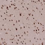 SS18 Antibody in Immunohistochemistry (Paraffin) (IHC (P))