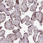 SS18 Antibody in Immunohistochemistry (Paraffin) (IHC (P))