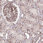 SS18 Antibody in Immunohistochemistry (Paraffin) (IHC (P))