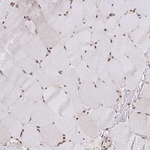 SS18 Antibody in Immunohistochemistry (Paraffin) (IHC (P))