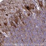 TMEM189 Antibody in Immunohistochemistry (Paraffin) (IHC (P))