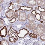 PLA2G12B Polyclonal Antibody