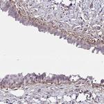 SLC14A1 Polyclonal Antibody
