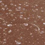 TTC7B Polyclonal Antibody