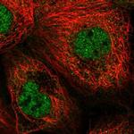 CDKL1 Antibody in Immunocytochemistry (ICC/IF)