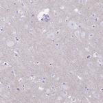 RHBDL3 Antibody in Immunohistochemistry (Paraffin) (IHC (P))