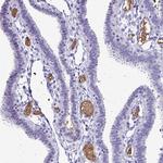 RHBDL3 Antibody in Immunohistochemistry (Paraffin) (IHC (P))