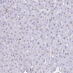 RHBDL3 Antibody in Immunohistochemistry (Paraffin) (IHC (P))